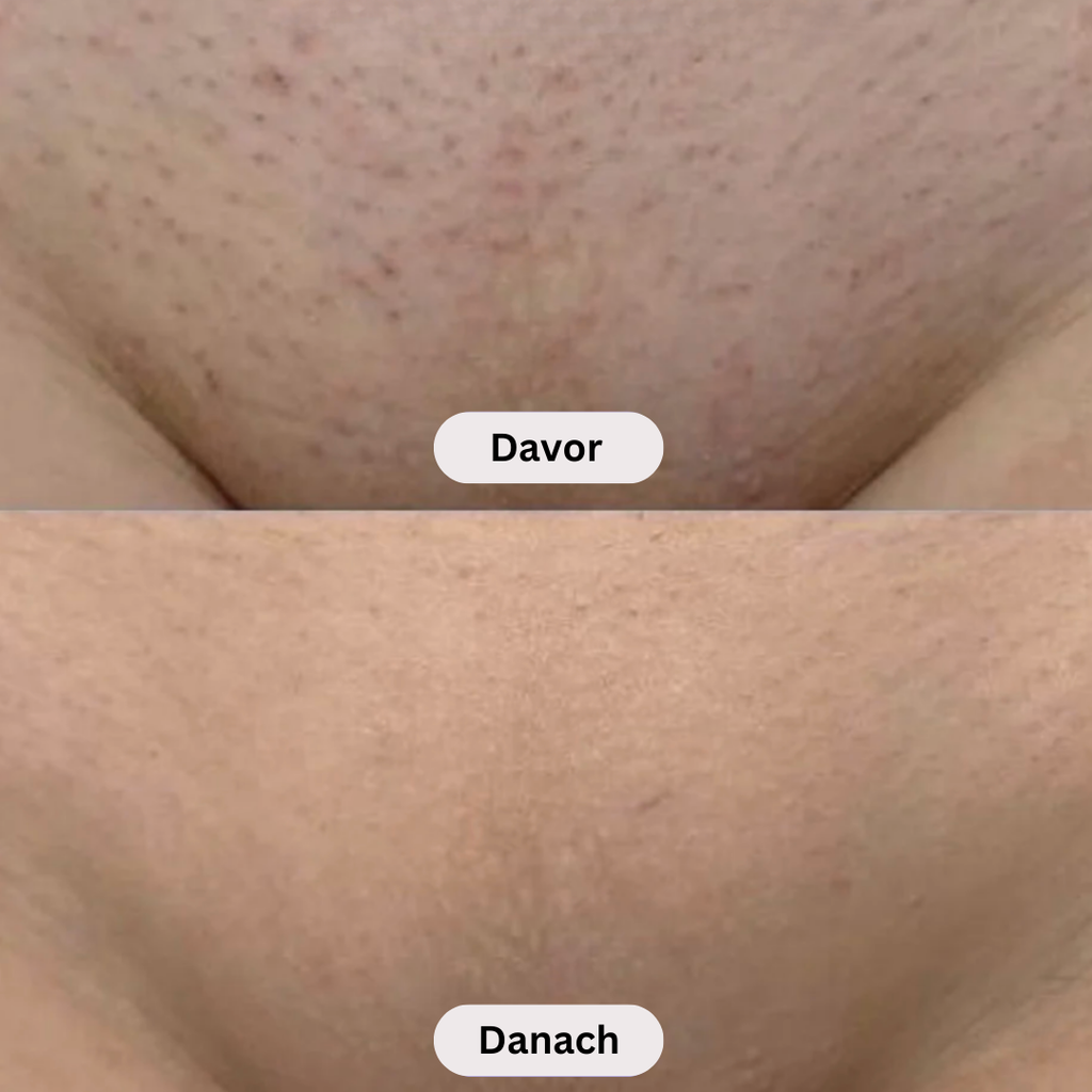 Bellevia - Schöne, glatte Haut jeden Tag